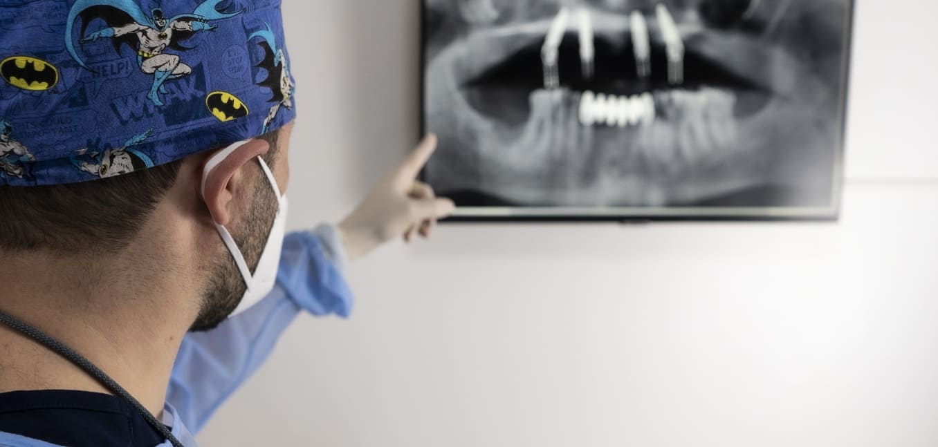 Studio Dentistico Rosella | Implantologia